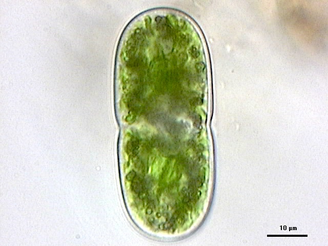 Actinotaenium americanum